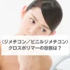 （ジメチコン／ビニルジメチコン）クロスポリマー