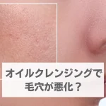 オイルクレンジング 毛穴 悪化