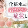 化粧水 合わない 症状